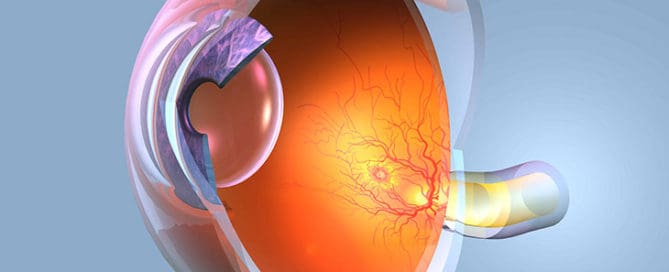 retinale migraene