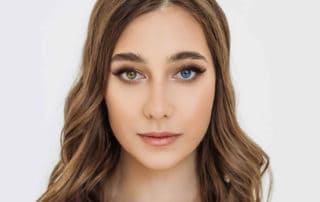 heterochromie der iris