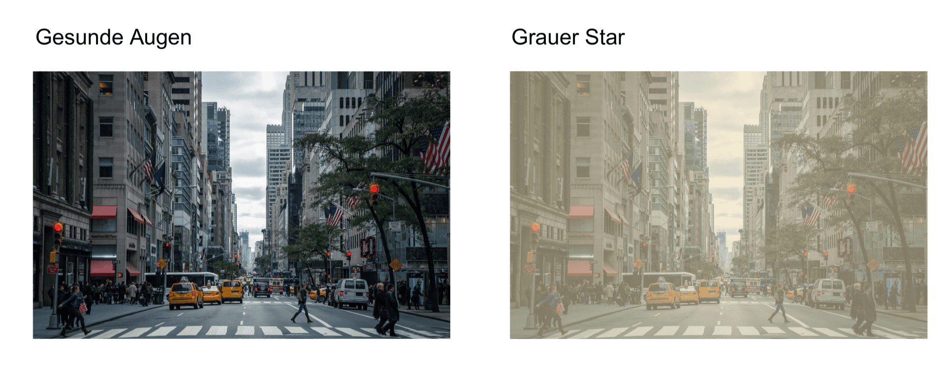 Vergleich grauer Star und gesundes Auge mit zwei Bildern. Das rechte Bild symbolisiert die Sicht mit einem grauen Star und ist etwas trüber als das linke.